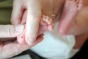 Bebeklerde Topuk Kanı Neden Alınır?